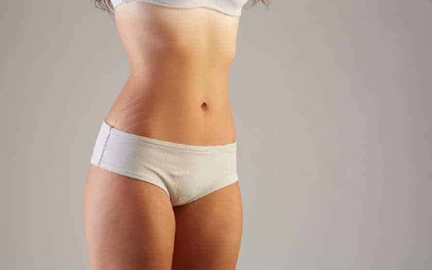 Tratamentos estéticos para remover estrias