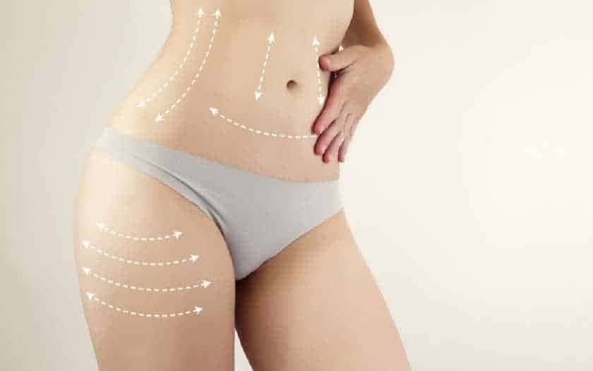 Quais os benefícios da lipoaspiração a laser