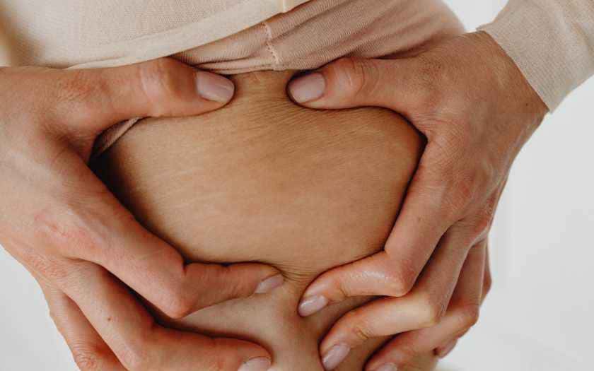 Ozonioterapia para estrias e celulites
