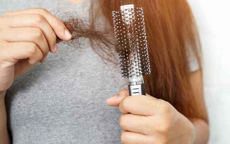 alopecia por tração