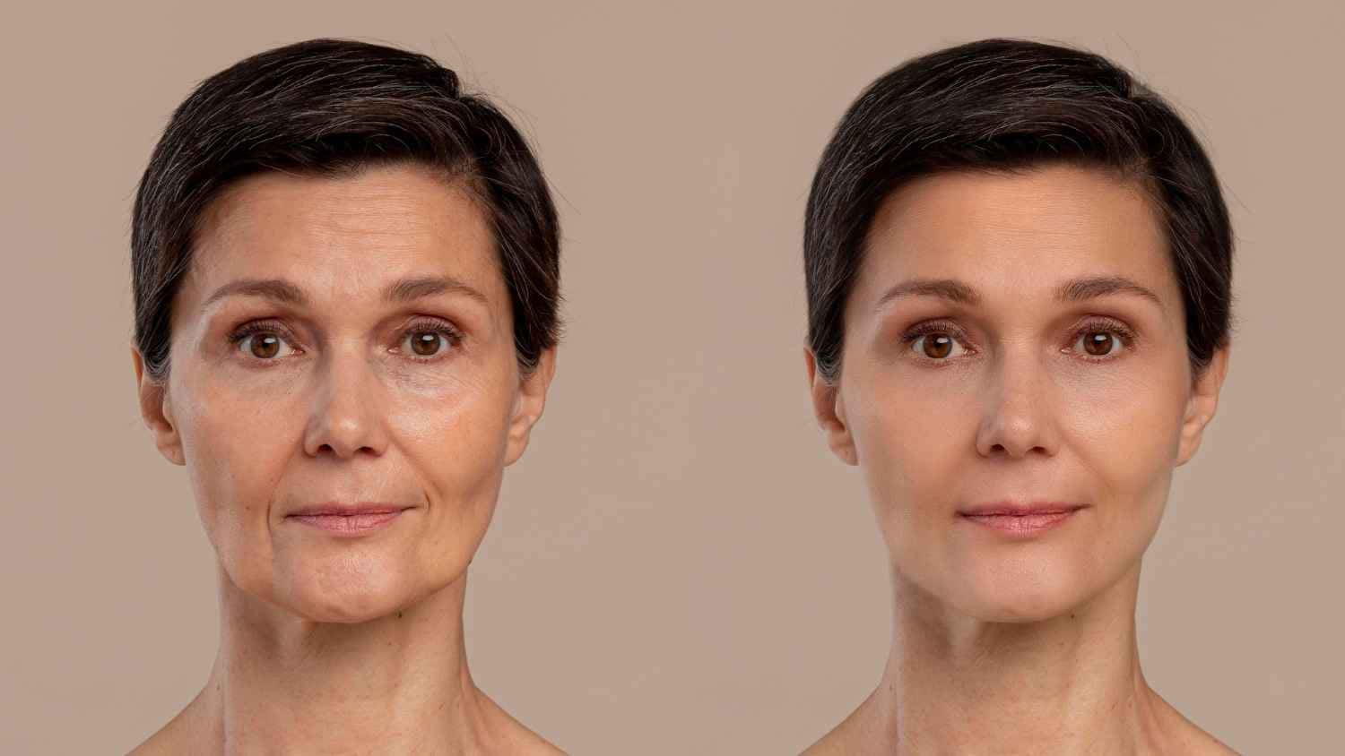 Adeus rugas aos 50 anos! Creme caseiro e natural é melhor que botox