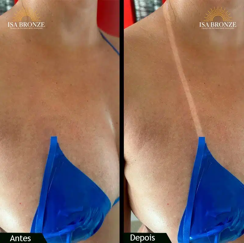 Bronzeamento a jato antes e depois