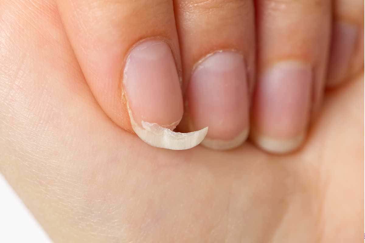 Unhas fracas depois do alongamento? Veja como recuperar a saúde delas: Dicas Essenciais
