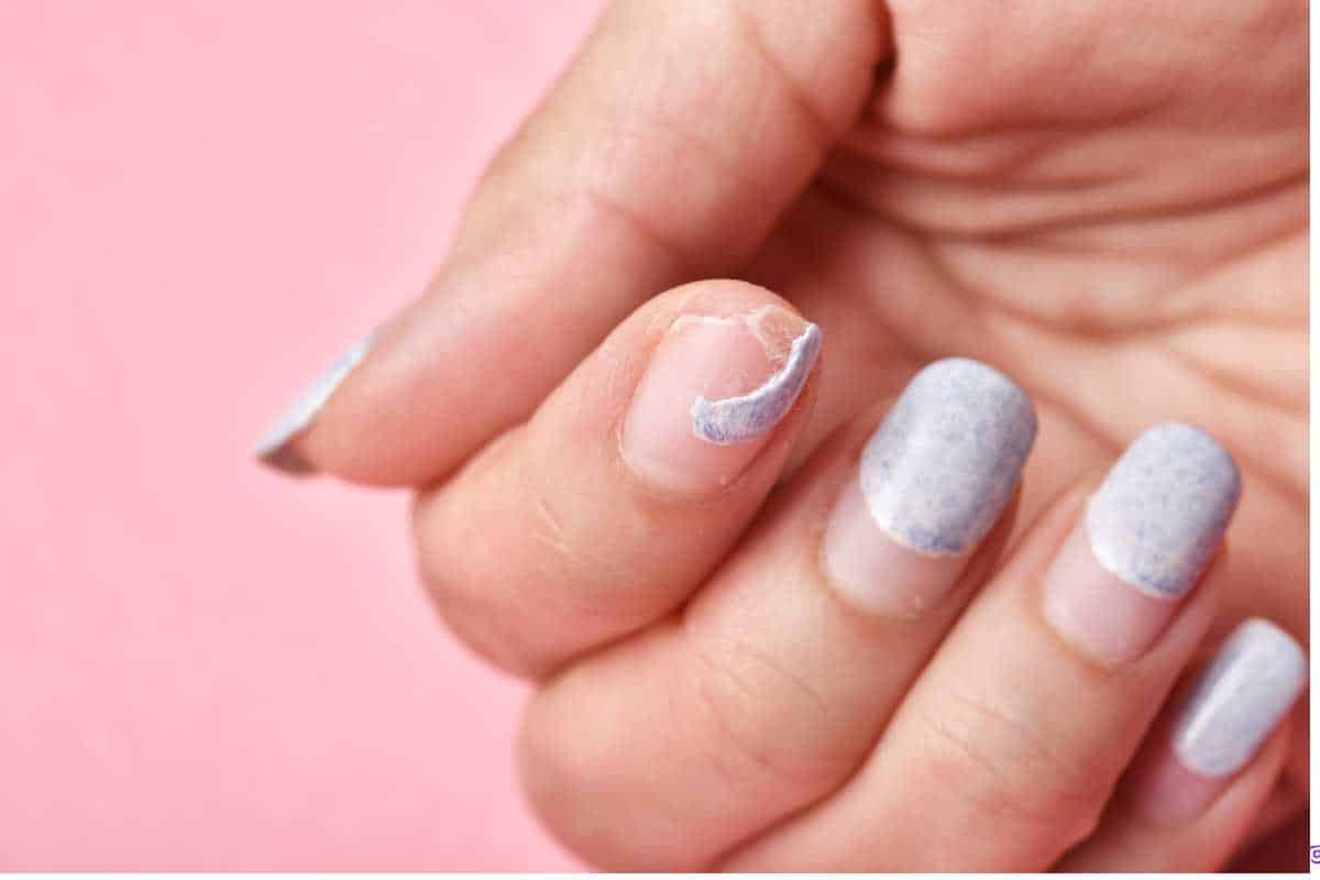 Estratégias para Recuperar a Saúde das Unhas
