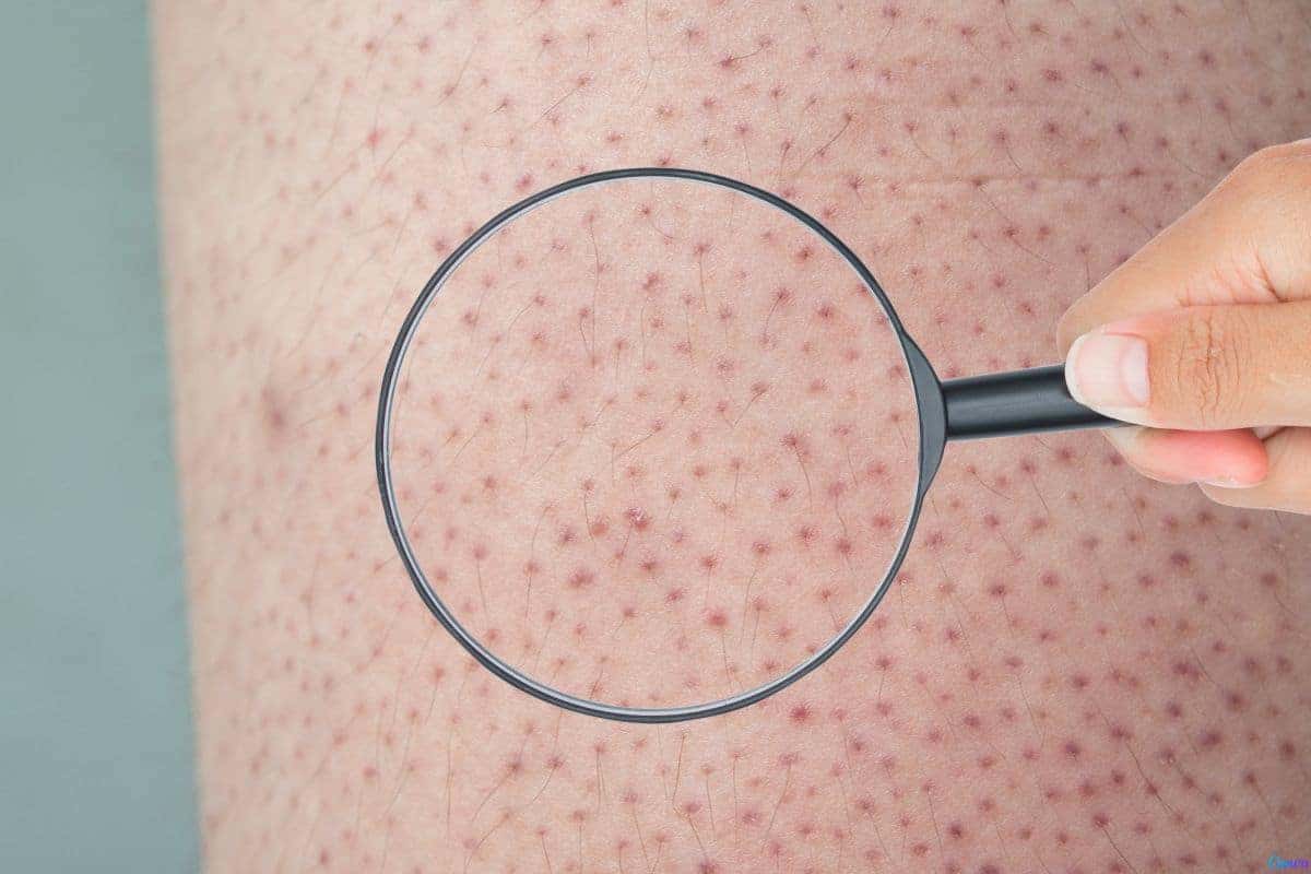 Tratamentos Naturais e Prevenção
