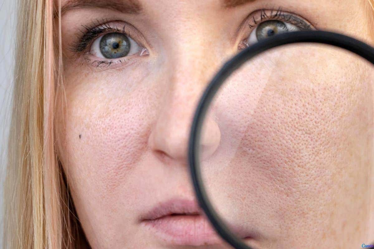 O que realmente funciona para fechar os poros? Dermatologistas respondem às principais dúvidas e revelam métodos eficazes comprovados pela ciência