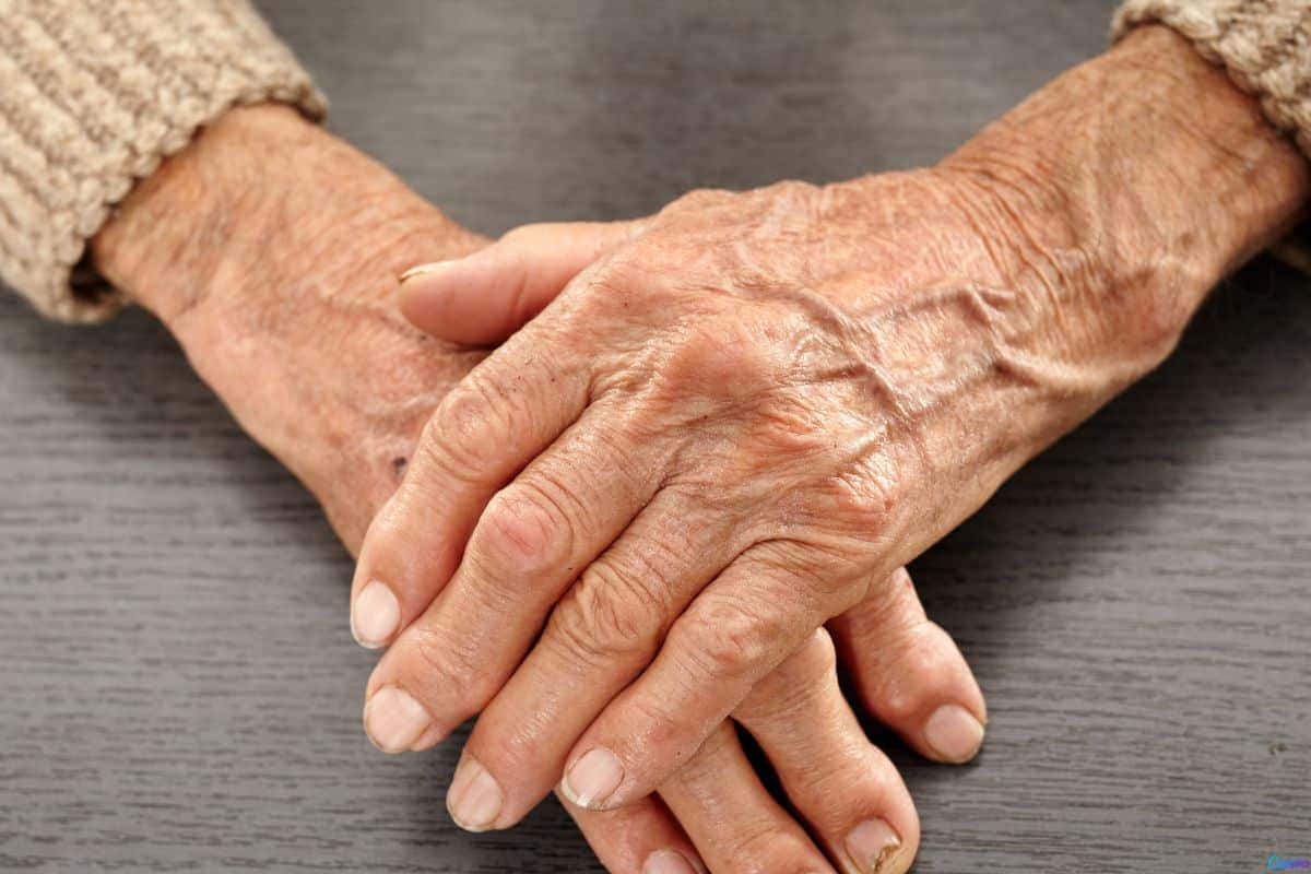 Por que a pele das mãos envelhece mais rápido